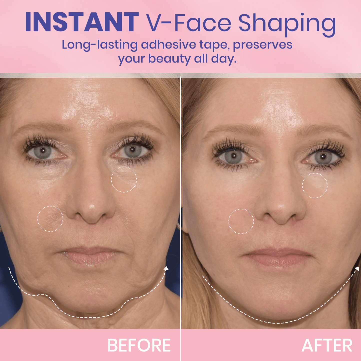 V-Face ๐ Invisible lifting tape